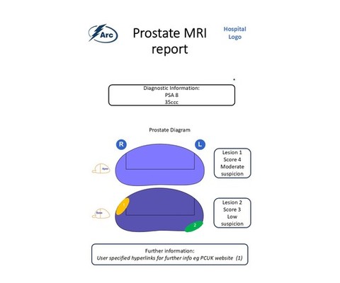 MRI report
