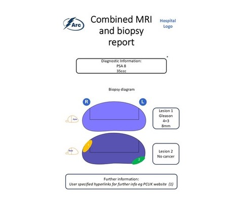 Combined MRI + biopsy
